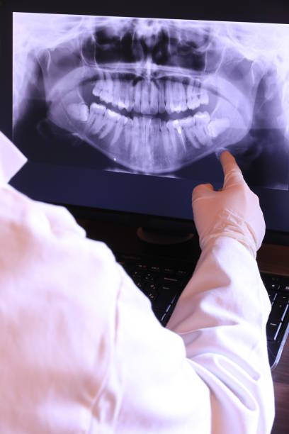 Best Emergency Dentist for Lost Fillings or Crowns in Chittenango, NY